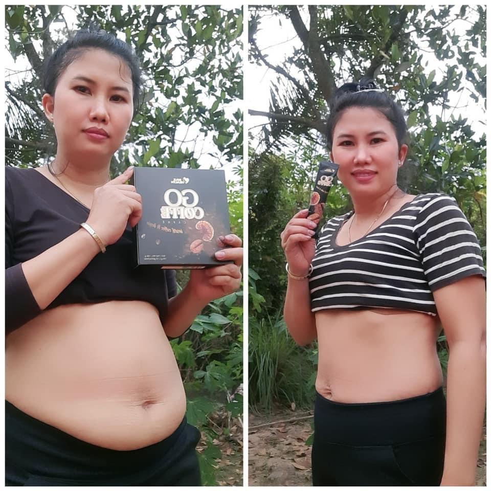 mỡ bụng được giảm bớt sau 1 liệu trình sử dụng