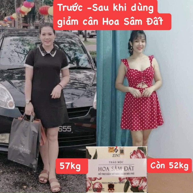Trước và sau khi sử dụng sản phẩm