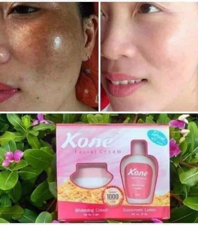 Đặc điểm nỗi bật của kem trị nám kone Thái Lan