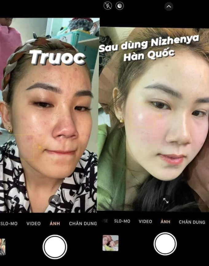 CÔNG DỤNG CỦA KEM NIZHENYA