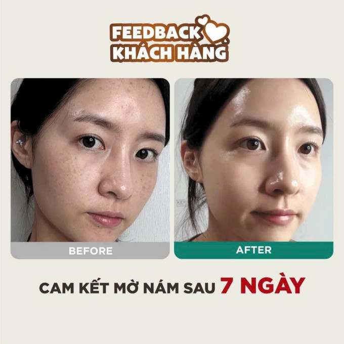 sự khác biệt trước và sau khi sử dụng